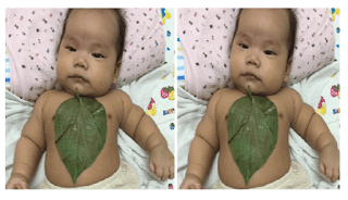 Viral Daun Sirih Bisa Atasi Batuk Pilek pada Bayi, Ini Kata Dokter