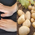 how to whiten hands and feet with potatoes
