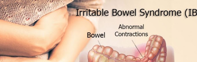 Irritable Bowel Syndrome (IBS) বা আই.বি.এস কি? - এর লক্ষণ সমূহ - কারন ও চিকিৎসা