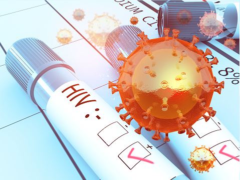 O caso COVID-19 de Stanford sugere uma possível ligação entre a variante Omicron e o HIV