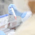 BAHIA TEM 1.872 CASOS DE H3N2 COM 72 ÓBITOS PELA DOENÇA 