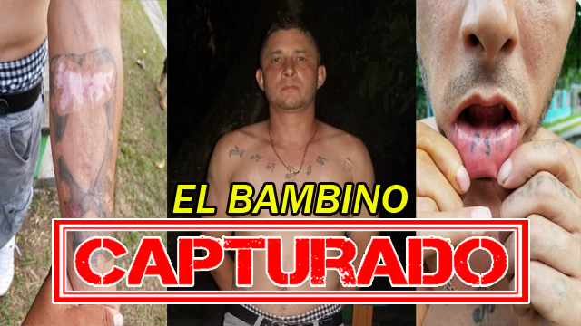 El Salvador: Atrapan a alias «El Bambino» tras intentar ocultar los tatuajes de la MS13