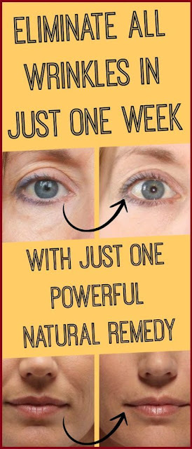 Eliminate All Wrinkles In One Week With This Powerful Natural Remedy