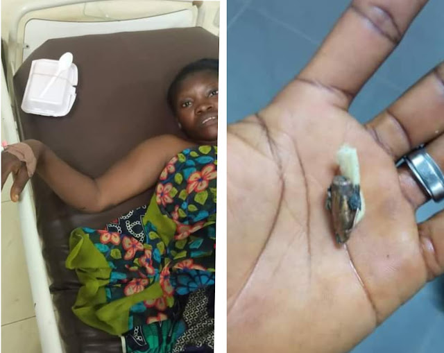 Read The Pathetic Story Of How stray bullet hit a Lady at Ikorodu after policeman allegedly fired shots during argument with Keke riders