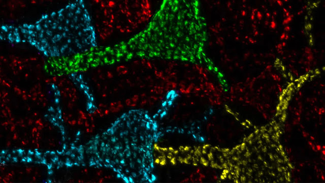 Un estudio revela la función de una misteriosa estructura encontrada en las neuronas