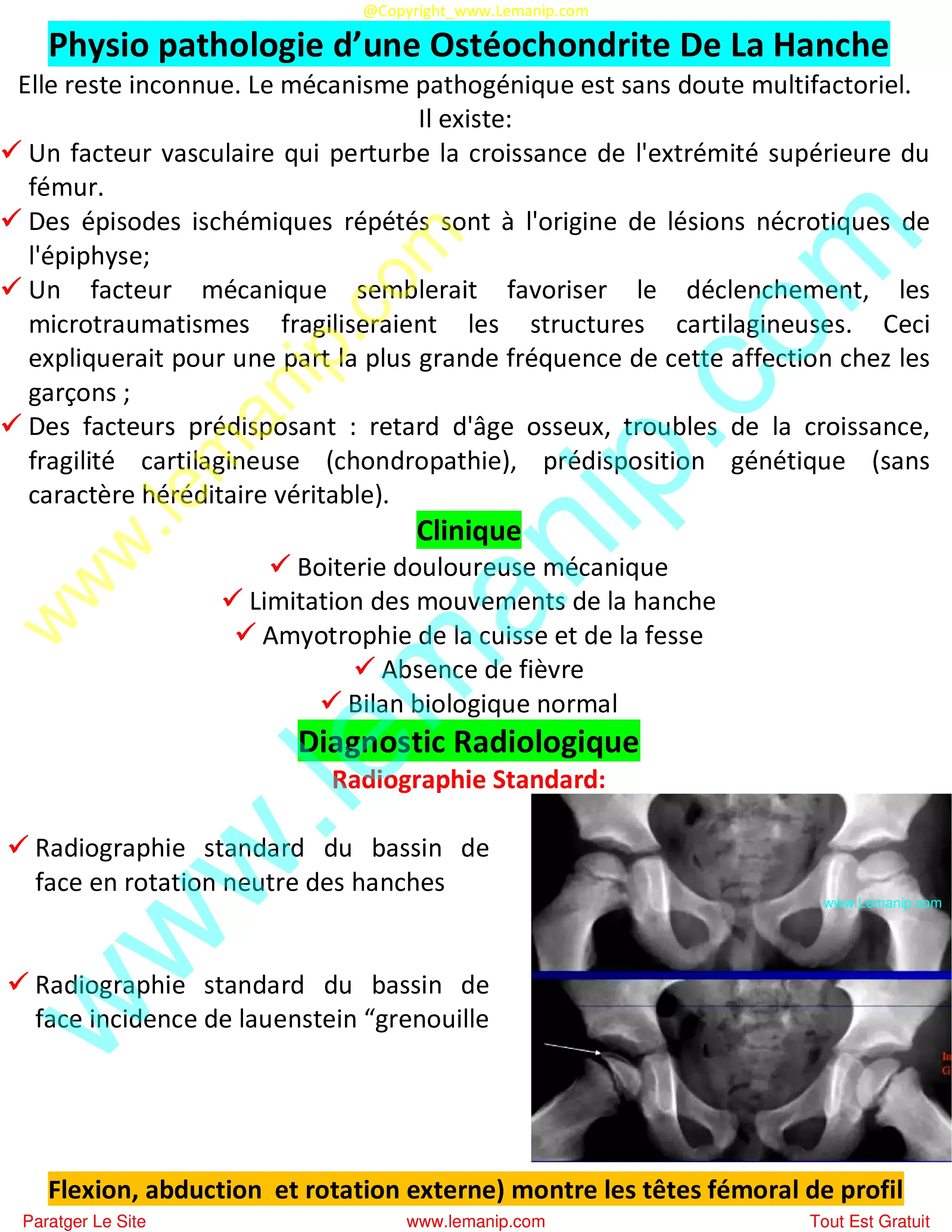 scoliosis hips uneven,hip abductor tear treatment,congenital hip dislocation,snapping hip syndrome surgery,subchondral fracture hip treatment,bilateral hip dysplasia infant,partial hip replacement after fracture,left hip impingement syndrome,avulsion fracture hip treatment,hip fracture surgery to connect broken bones internal fixation