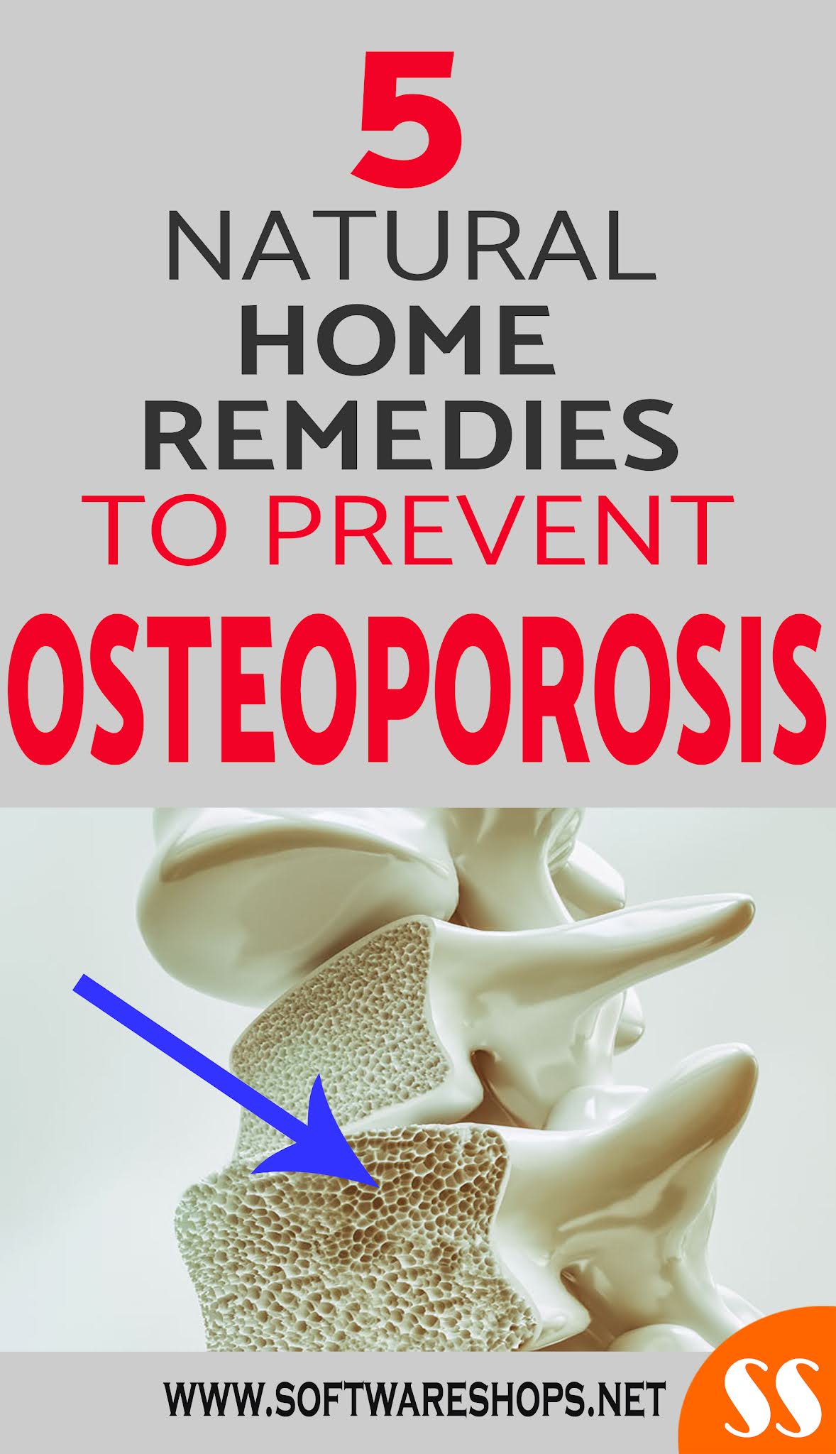 5 NATURAL REMEDIES TO PREVENT OSTEOPOROSIS