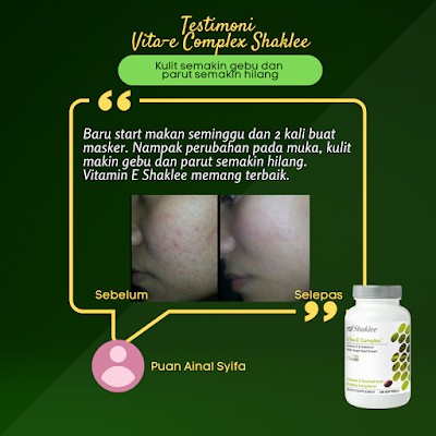 Kelebihan dan Kebaikan Vitamin E Complex Shaklee