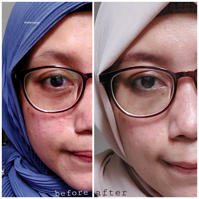 manfaat  Y.O.U The Radiance White Nourishing Serum untuk memperkuat skin barrier dan mencerahkan kulit