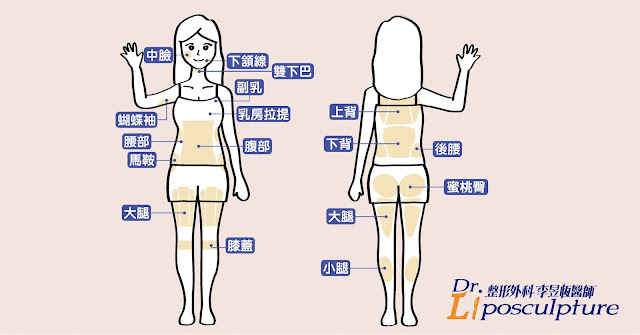 台南威塑抽脂推薦