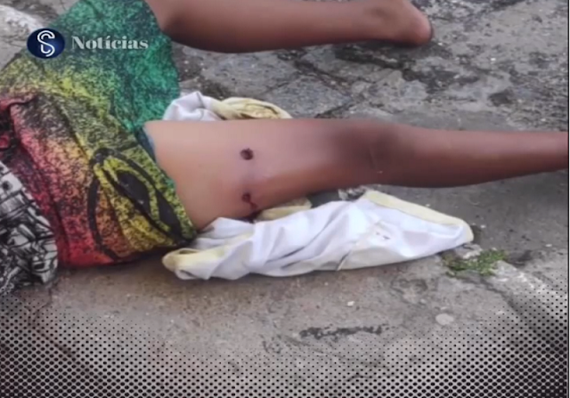 Guerra de ovos acaba com jovem baleado na perna durante o carnaval em Aracaju