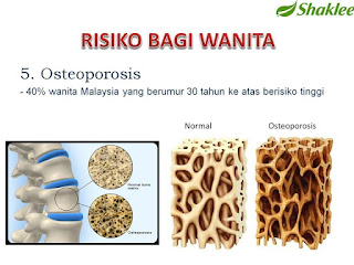 Kebaikan dan Manfaat Kalsium Ostematrix Shaklee Kepada Wanita