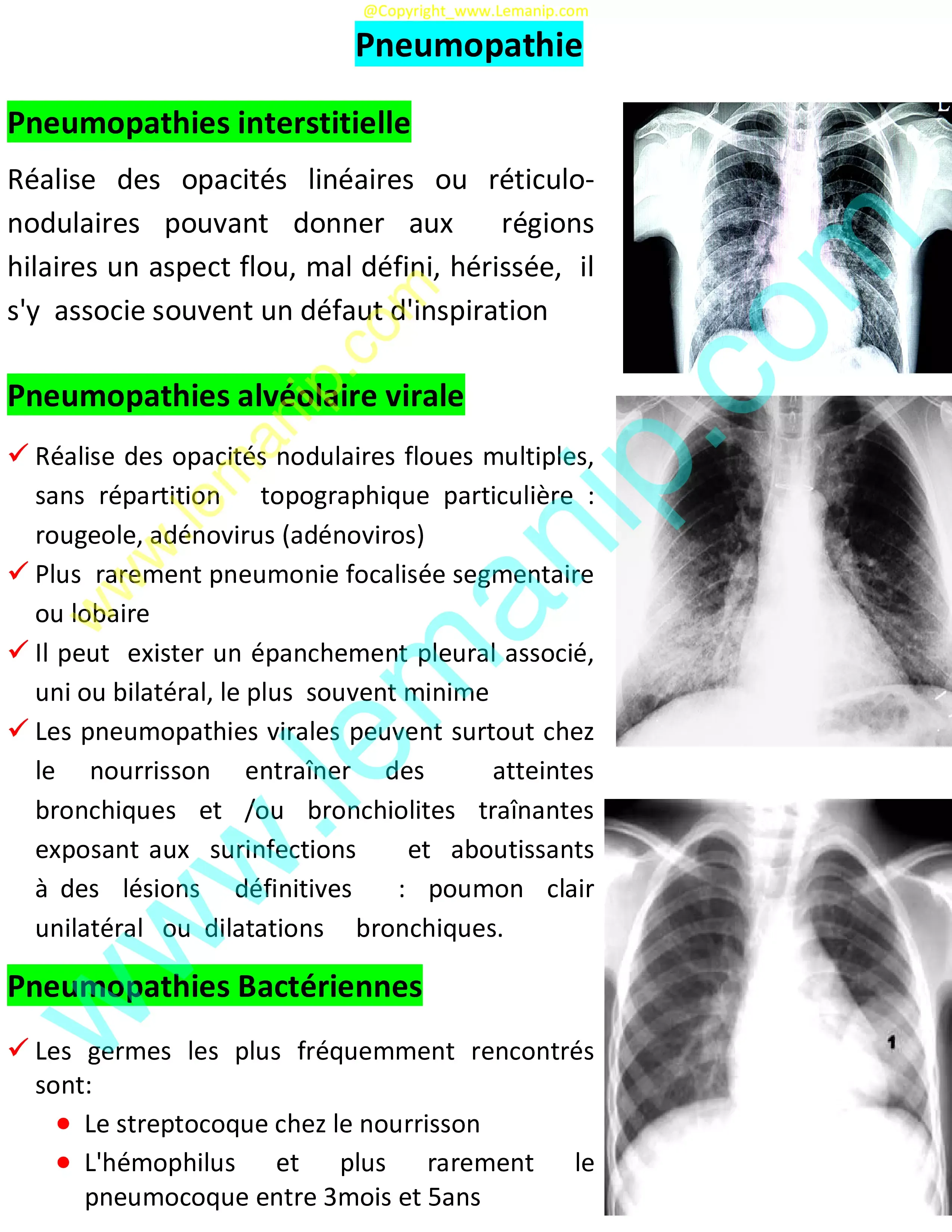 pulmonologist near me pediatric,lvpg pediatric pulmonology,mgh pediatric pulmonary,pediatric pulmonary,dr rosenberg pediatric pulmonologist,pediatric pulmonary specialist,pediatric pulmonary near me,pediatric pulmonary doctor,pulmonary pediatrics near me,riley hospital pulmonology