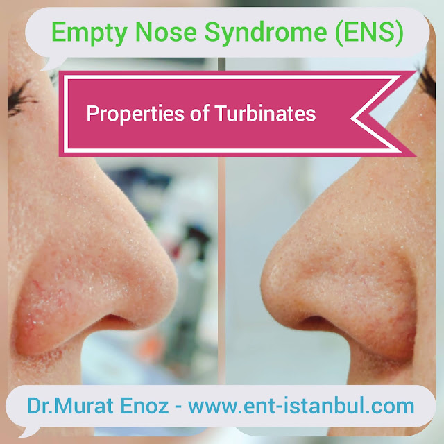 cold turbinate, healthy turbinates,Empty Nose Syndrome, ENS,Nasal physiology,Nasal Hyperventilation,