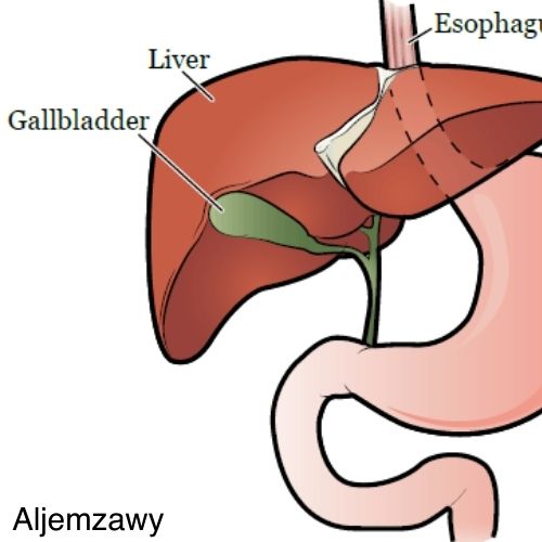 Post-cholecystectomy syndrome and what problems do you have?