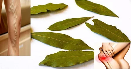 bay leaf and olive oil for varicose veins.