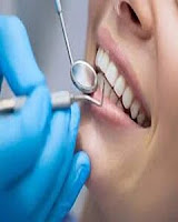 اشطر و أفضل دكتور اسنان في ابوظبي ، Best dentist Abu Dhabi