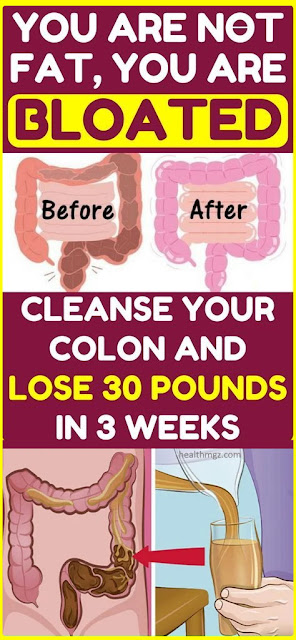 Cleanse Your Colon And Lose 30 Pounds Within A Month!