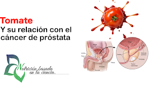 Los antioxidantes del tomate y sus beneficios para el cáncer de próstata - Nutrición basada en la ciencia. 
