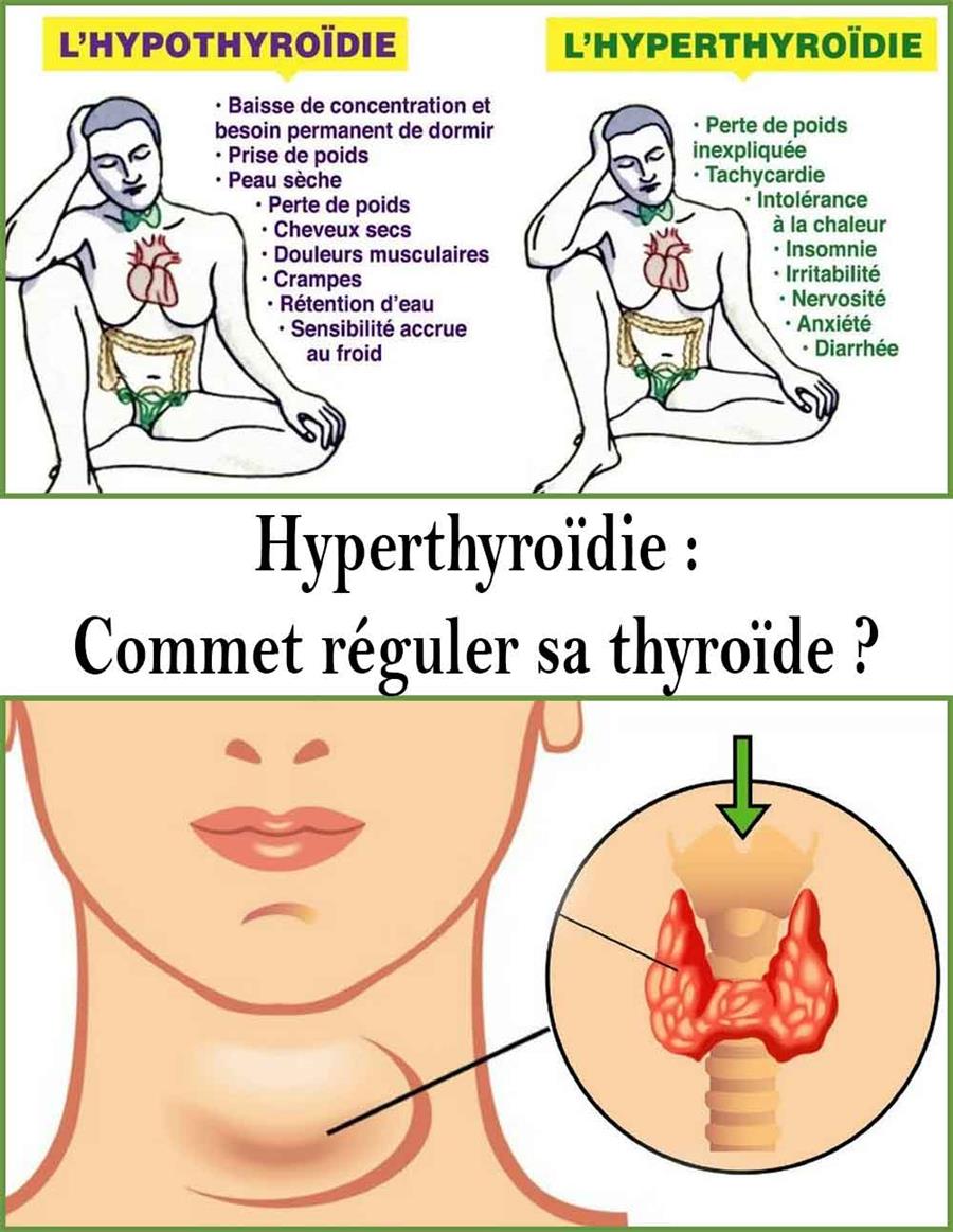 Hyperthyroïdie : commet réguler sa thyroïde ?