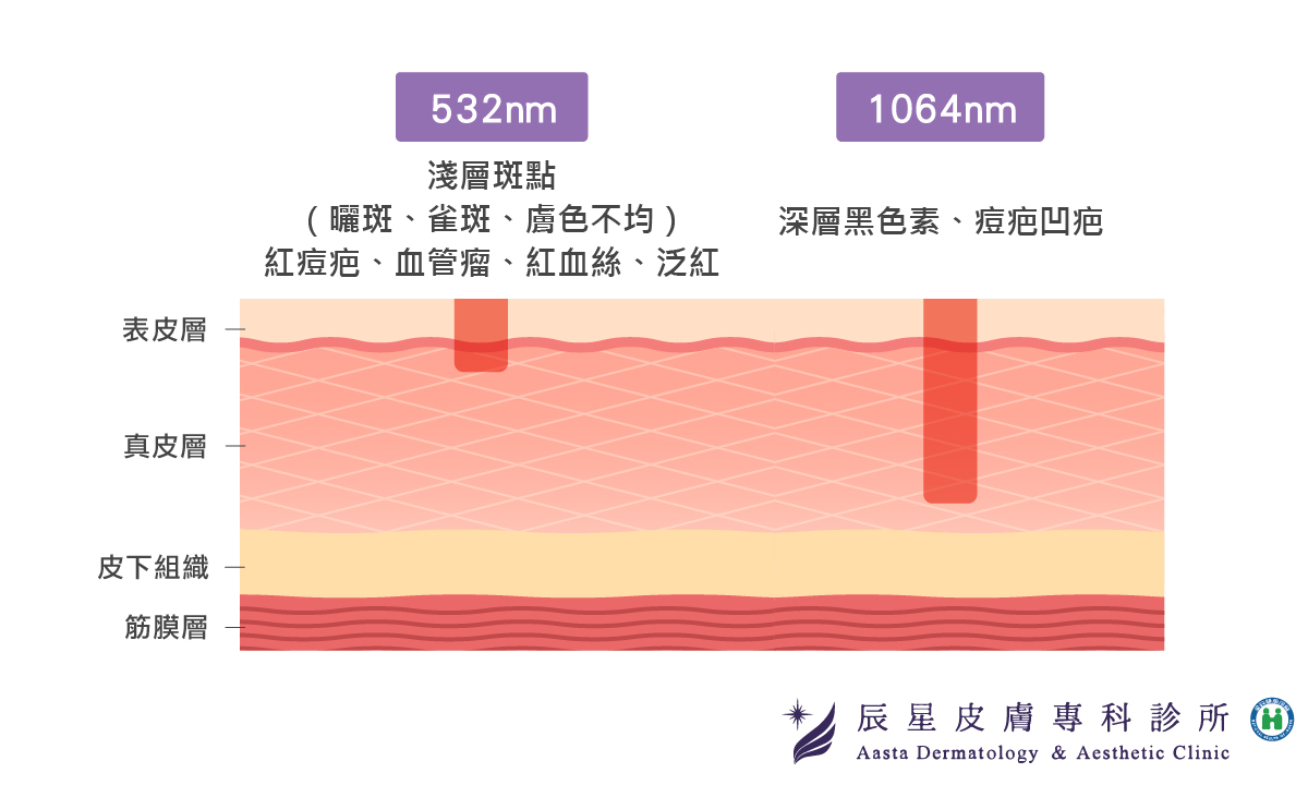 皮秒雷射懶人包