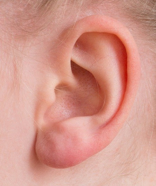 Ear Seeds: What Are They and How Do They Work?