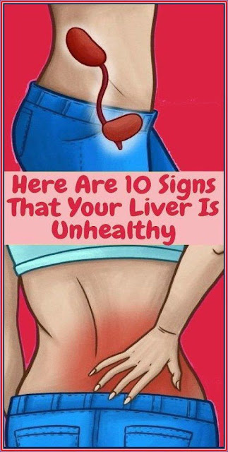 10 Warning Signals of Liver Damage You Should Not Ignore