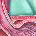 What does the Future Hold for Gastroesophageal Cancer?