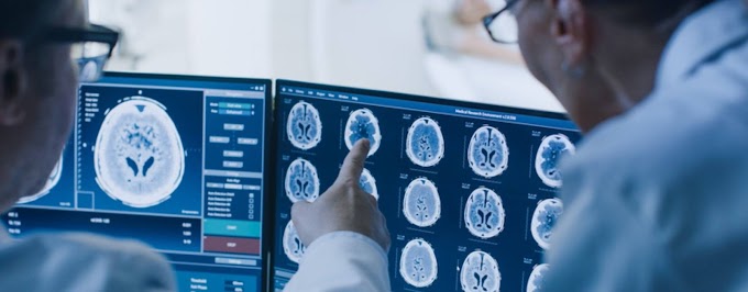 Medical Imaging Market Insights, Trends, Opportunity & Forecast to 2027