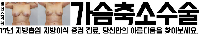거대유방 가슴축소수술