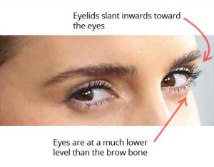 Eyebrow