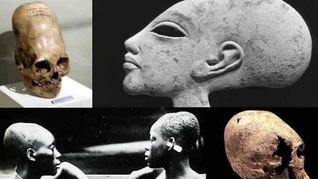 Ancient Alien elongated skulls from around the world.