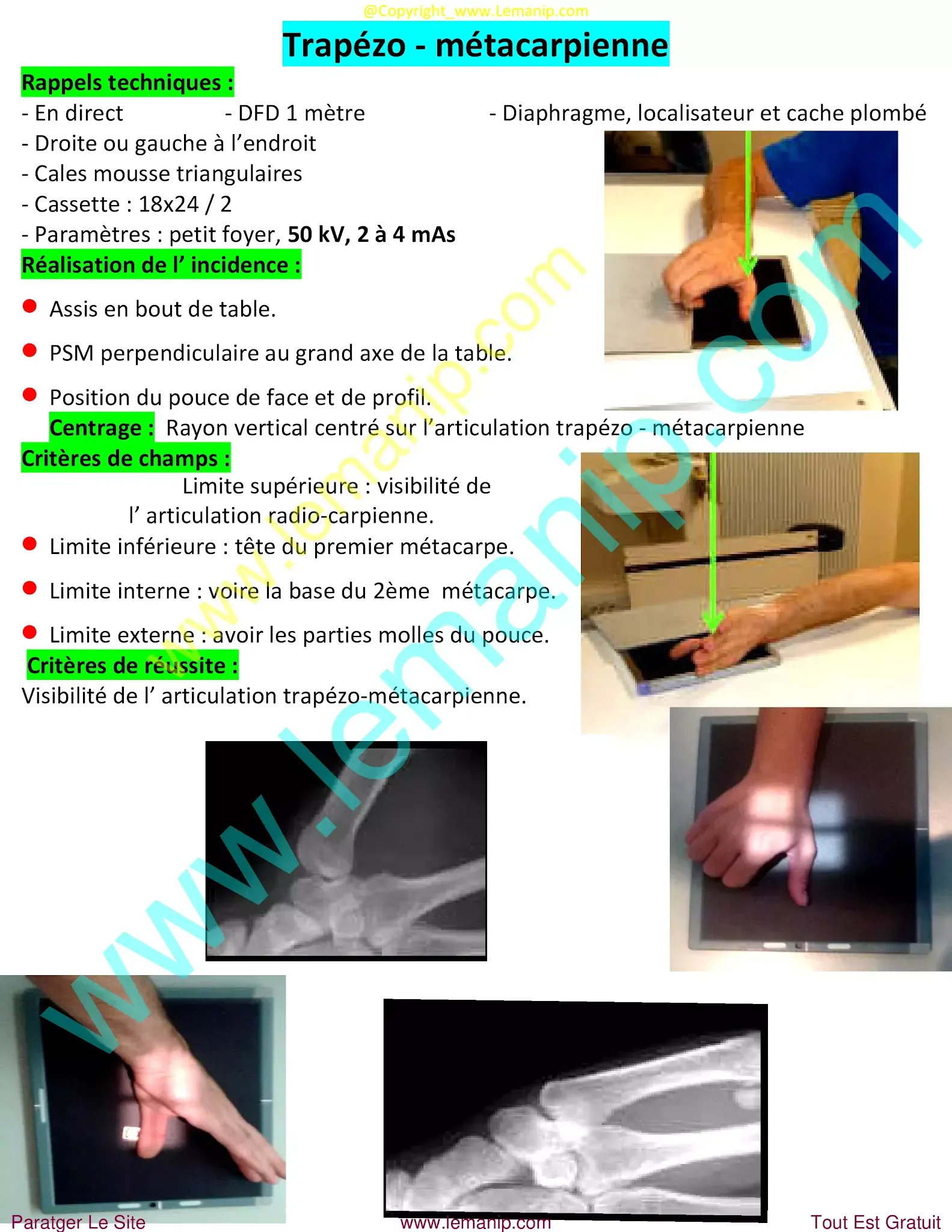 avant bras,elbow pain orthopedic doctor,dr henry hand and wrist,elbow pain treatment near me,premier orthopedics hand specialist,bras avant,hand man,orthopedic hand,orthopedic wrist,orthopedic elbow,orthopedic carpal tunnel