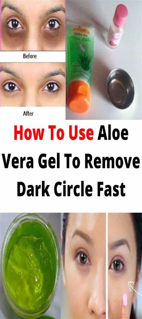 How To Use Aloe Vera Gel To Remove Dark Circle Fast