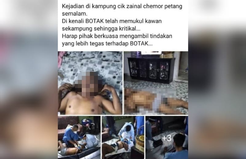 Kes pukul lelaki 44 tahun, polis cari BOTAK untuk bantu siasatan