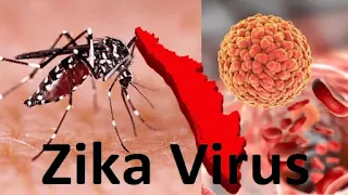 Zika Virus Disease