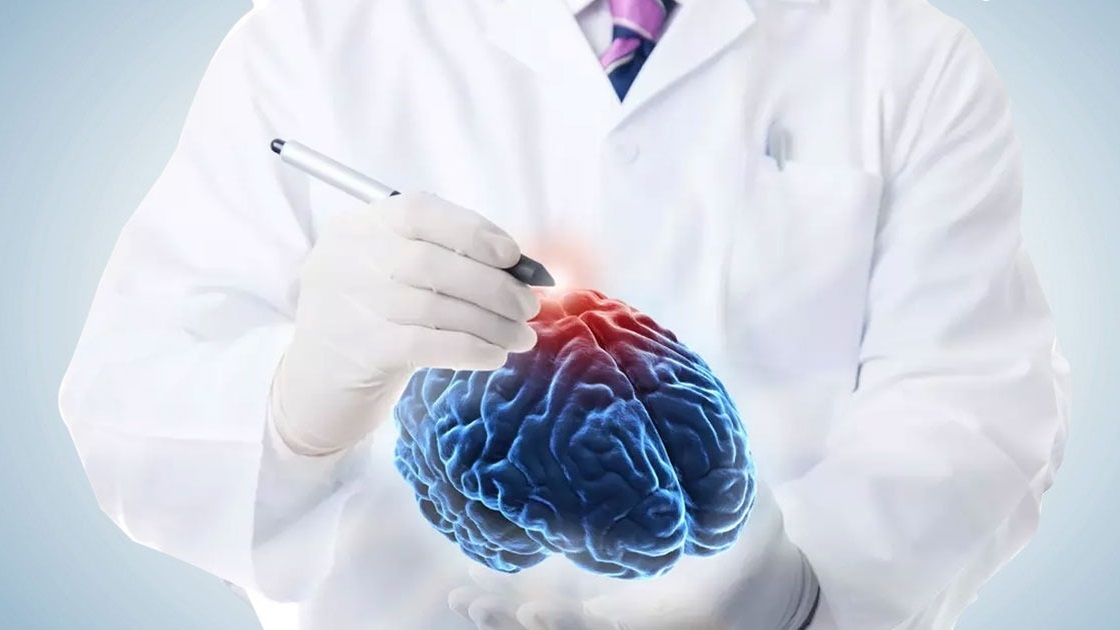 Best Neurology Doctors in India