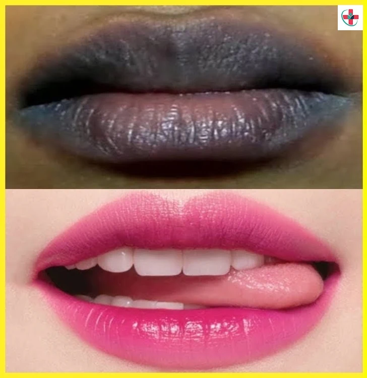 What lips can tell you about your health