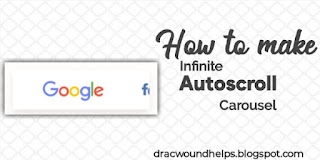 Infinite Autoscroll Carousel