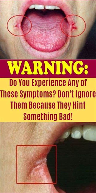 WARNING! Do You Experience Any Of These Symptoms? Don’t Ignore Them Because They Hint Something Bad!