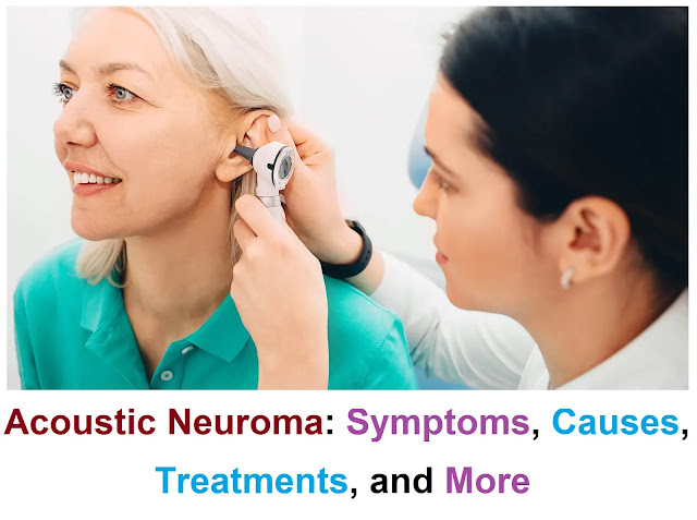 Acoustic Neuroma: Symptoms, Causes, Treatments, and More