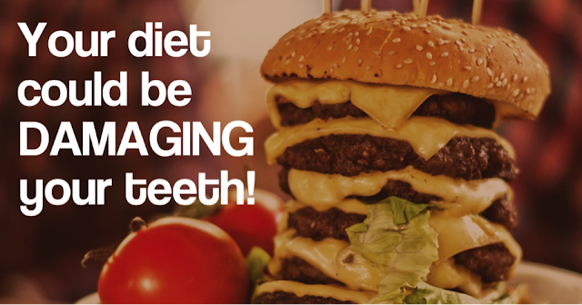 Junk food and oral hygiene
