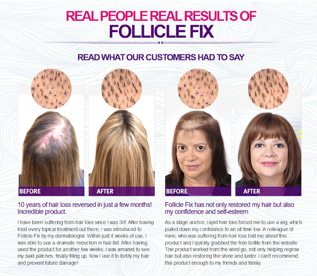 What Customers are Saying About Follicle Fix Hair Regrowth Formula