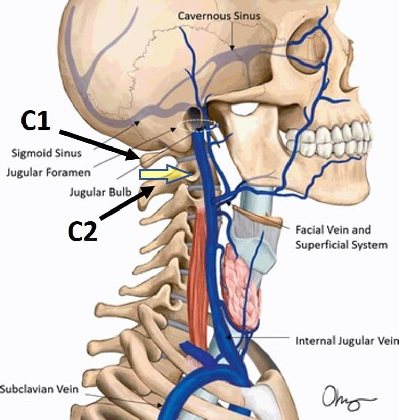 Важно понимать, что шейный симпатический узел проходит прямо вдоль спинного мозга, а верхний шейный симпатический узел находится прямо на уровне С2.
