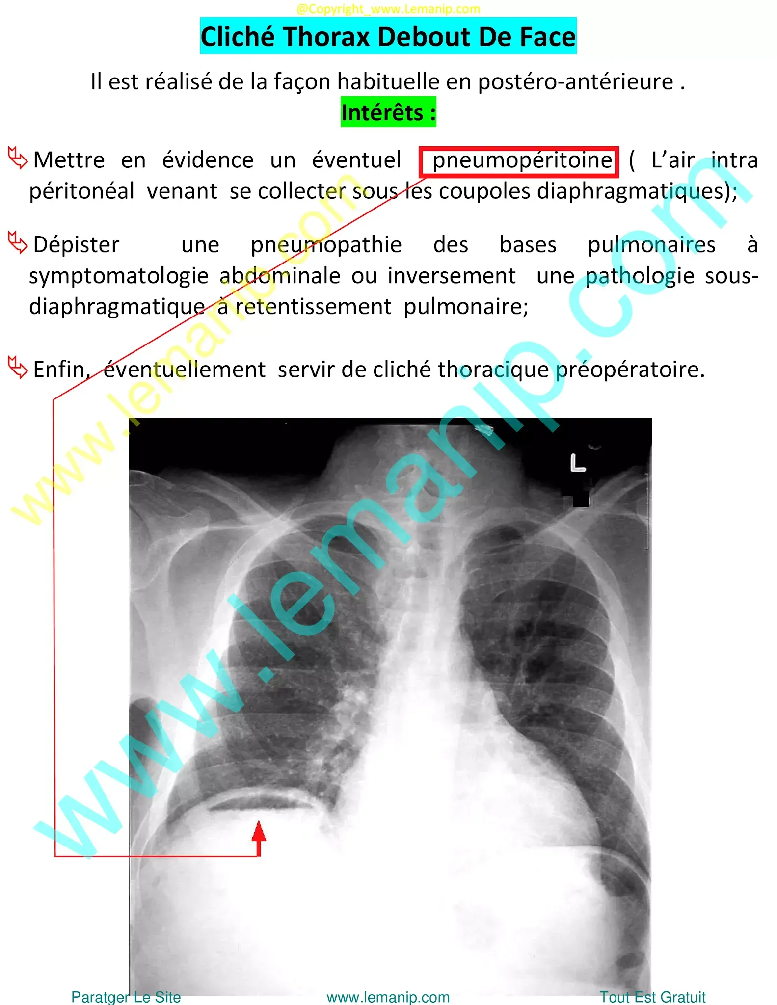 abdominal radiography,abdominal xray,abd xray,belly x ray,x ray on abdomen,xray on abdomen,abdominal xray price,stomach x ray,stomach on xray,pain 2 inches left of belly button after eating,lower back pain that wraps around to abdomen