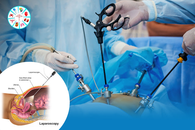 Laparoscopic surgery in Shaikpet, Hyderabad