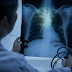 Bahia registra mais de 3 mil mortes por pneumonia em 2024; até outubro, a média é de 11 mortes diárias