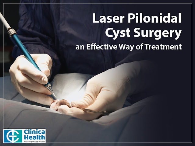 pilonidal sinus treatment