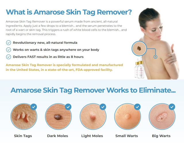 Amarose Skin Tag Removal Serum Reviews: Exclusive Eye Cream Boost Collagen Level & Improve Skin Texture!