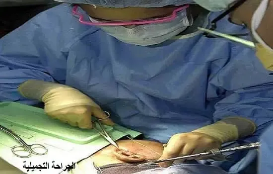 الجراحة التجميلية بين الصحة و الجمال للإنسان